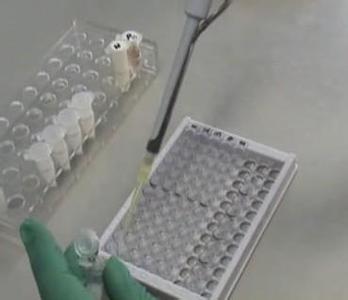小鼠PGD2 elisa检测试剂盒