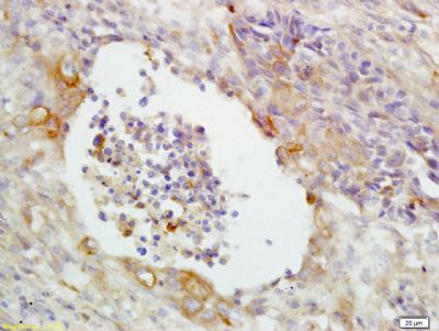 CD14内毒素受体抗体