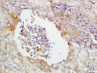 CD14内毒素受体抗体