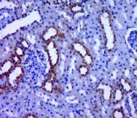 PDHB antibody