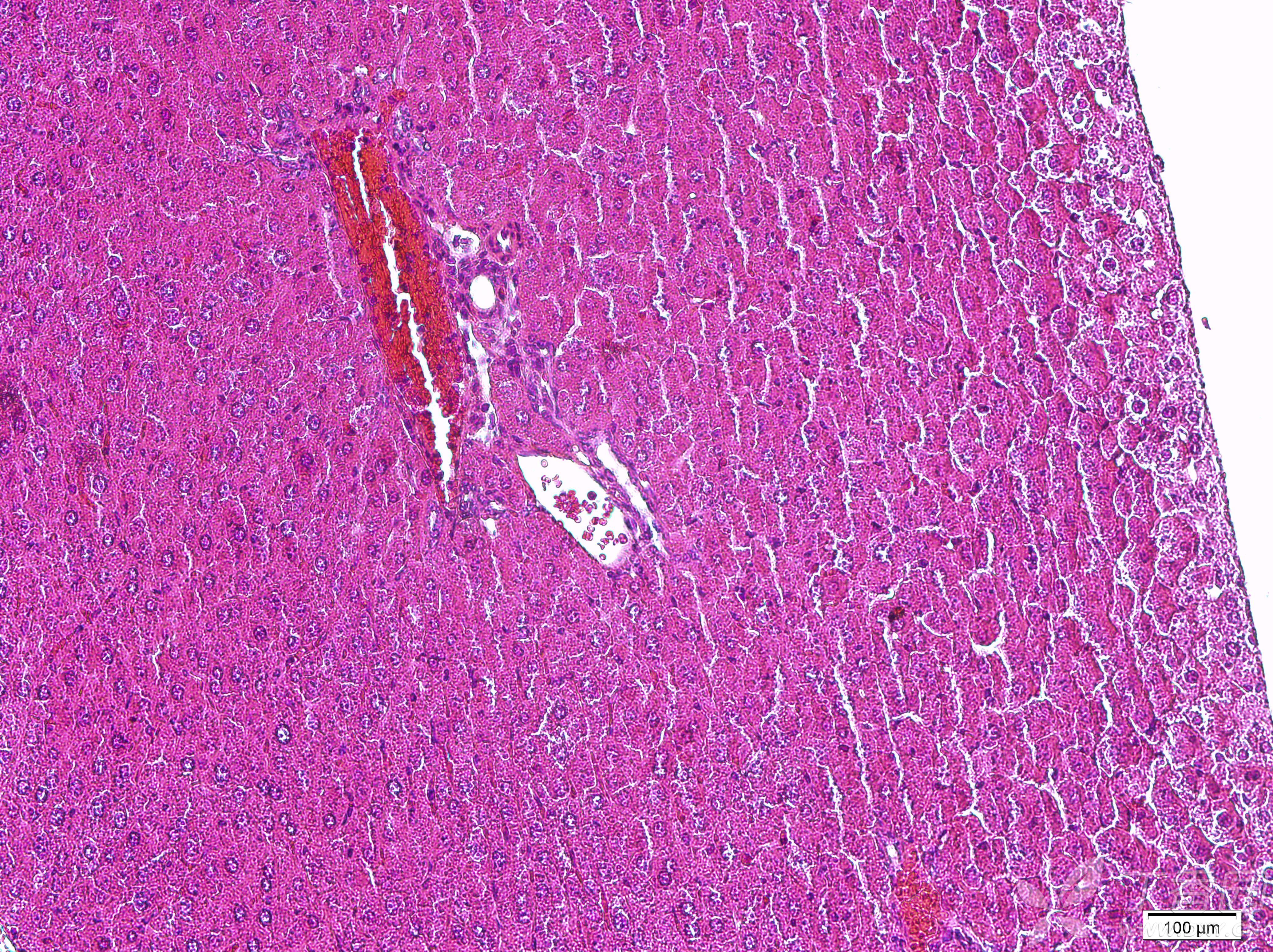 肝切片显微镜图图片