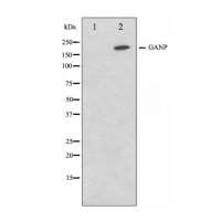 Phospho-TRAF2 (Ser11) Antibody 多克隆抗体