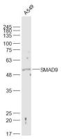 ATP1A1 antibody