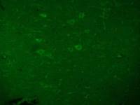 Beta galactosidase antibody