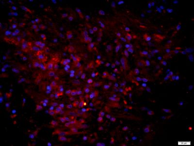 CLIC6氯离子通道蛋白6抗体