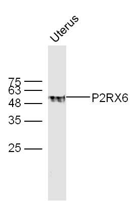 P2RX6三磷酸腺苷受体P2X6抗体