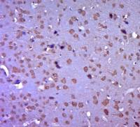 Vesicle docking protein p115 antibody