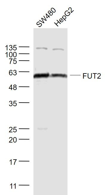 FUT11岩藻糖转移酶11抗体