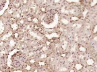 CDKN2B/p15 INK4b antibody