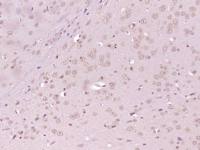 phospho-AKT1 + AKT2 + AKT3 (Thr308+Thr309+Thr305) antibody