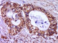 phospho-CDKN1A/p21 (Ser130) antibody