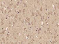 phospho-Amyloid Precursor Protein (Ser730) antibody