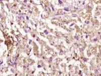 phospho-IKK beta(Ser471) antibody