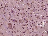 phospho-HOMER3 (Thr36) antibody