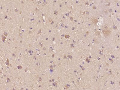 phospho-BNIP3 (Ser95)磷酸化促凋亡调节蛋白BNIP3抗体