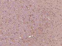 phospho-AKT1(Thr34) antibody