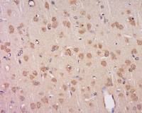 PFKFB2/PFK2 antibody