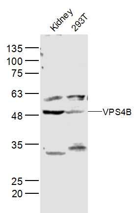 VPS4B液泡蛋白分选蛋白4B抗体