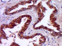 phospho-Androgen Receptor (Ser213) antibody