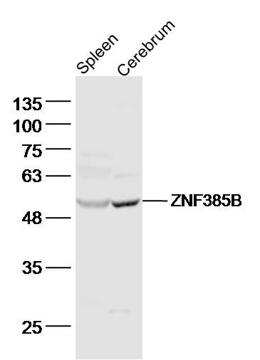ZNF385B锌指蛋白385B抗体