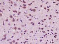 phospho-Tau (Ser356) antibody