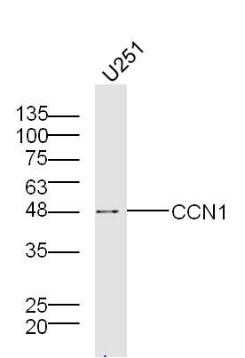 CCN1富半胱氨酸肝素结合蛋白61抗体