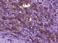 Latency-associated peptide antibody