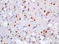 Phospho-Histone H2A.X (Tyr143) antibody