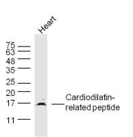 Cardiodilatin-related peptide antibody