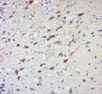 phospho-RPS6KB1(Ser441+Thr444) antibody