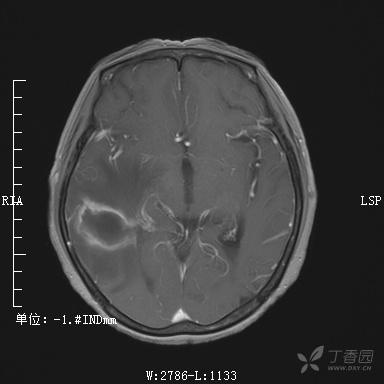 3287102195828770256-8w.jpg