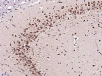 phospho-RPS6KB1(Ser417) antibody