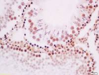 phospho-ROCK2(Tyr256) antibody