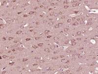 phospho-Alpha synuclein (Tyr136) antibody