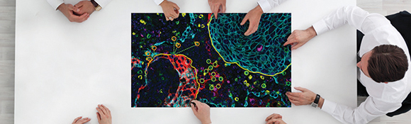 观察并定量肿瘤微环境中的细胞相互作用