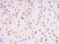 Phospho-PDPK1(Ser393) antibody