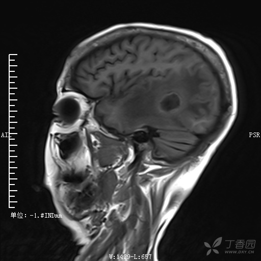 3287102041210207687-8w.jpg