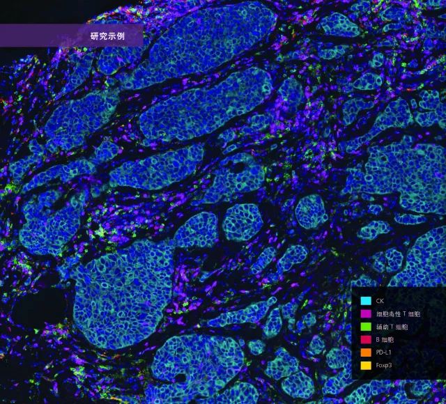 观察并定量肿瘤微环境中的细胞相互作用