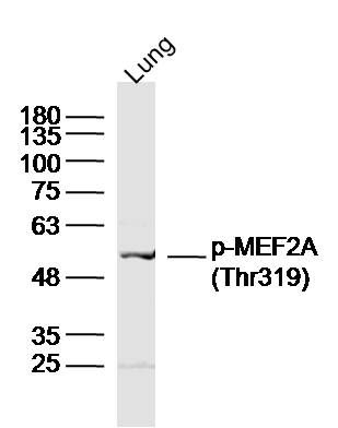 Phospho-MEF2A(Thr319) antibody