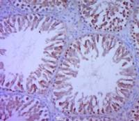 Phospho-Paxillin(Tyr88) antibody