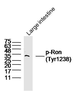 phospho-Ron(Tyr1238) antibody