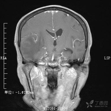 3287102223746057854-8w.jpg
