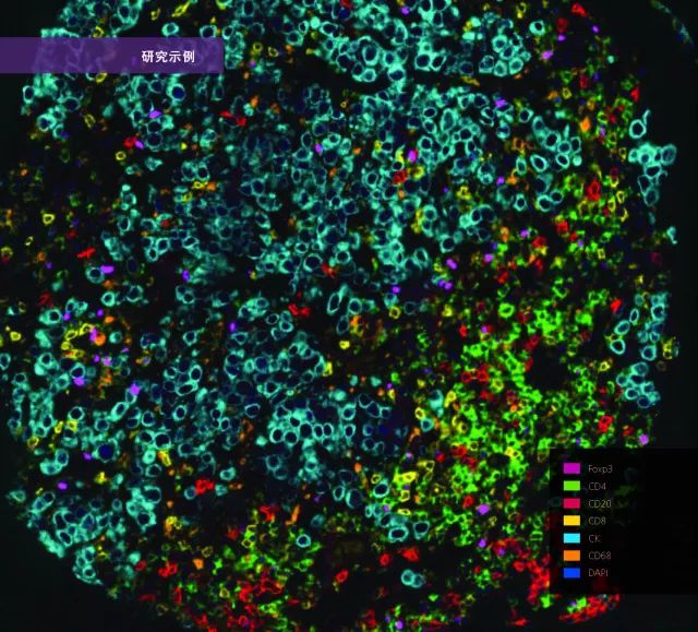 观察并定量肿瘤微环境中的细胞相互作用