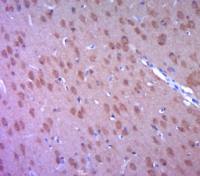 phospho-SYN1(Ser62+Ser67) antibody