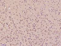 phospho-MAPKAPK5(Thr182) antibody