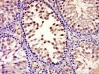 phospho-MAP4K4(Ser801) antibody