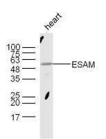ESAM antibody