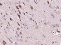 phospho-PIK3R2 (Tyr467) antibody