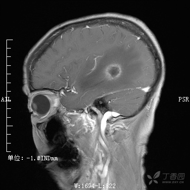 3287102172206449991-8w.jpg