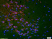 Prostaglandin E Receptor EP1 antibody